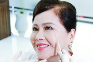 nâng cung mày kiêng ăn