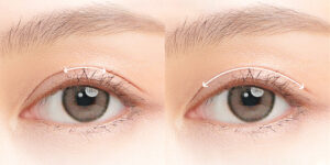 nen cat mi tren hay nhan mi