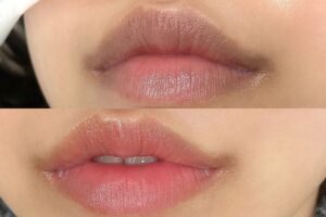 Phun môi bị nhạt lòng môi