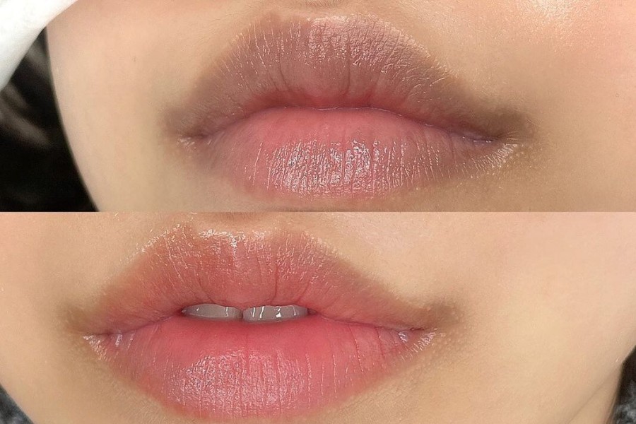 Phun môi collagen là gì? Có nên thực hiện không? 2 Phun môi bị nhạt lòng môi