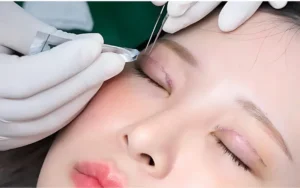 nhan mi co can cat chi khong.jpg