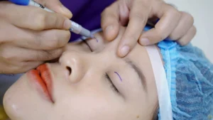 nhan mi mat sung bao lau thi het cach khac phuc tinh trang sung 1 1fedfd7bd3