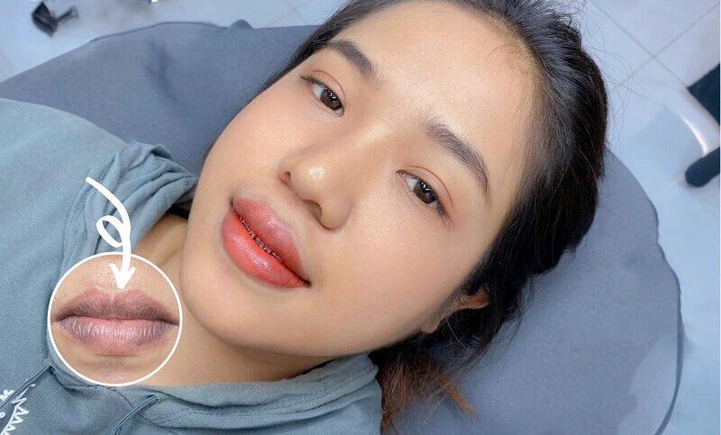 Chia sẻ nhật ký phun môi 60 ngày chi tiết từ A-Z bạn phải xem! 5 nhat ky phun moi 1 663c7c5599d67 e1757746520804