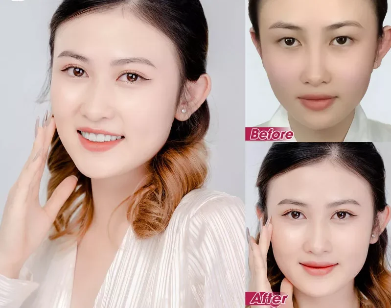 Tạo hình mí mắt trên 9 nhung hinh anh cat mi mat 11 e1758695106250