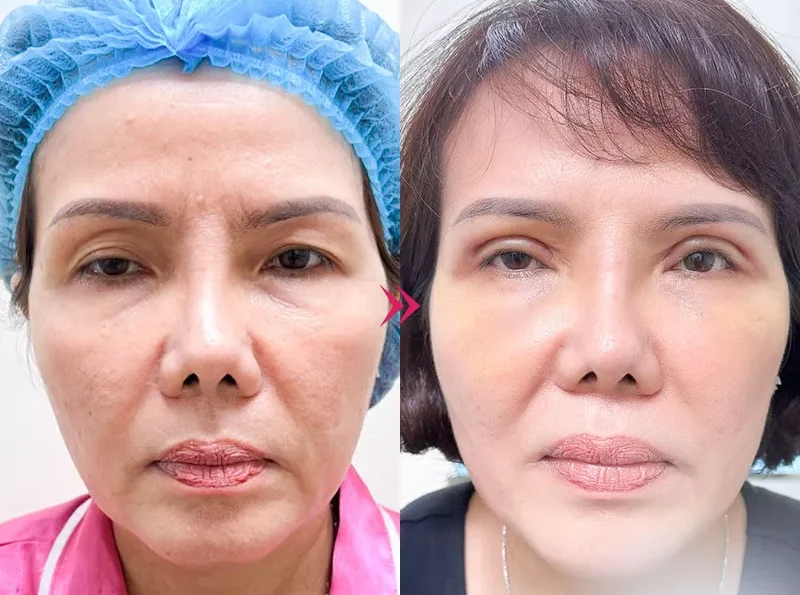 nhung hinh anh cat mi mat 15 e1758695290699