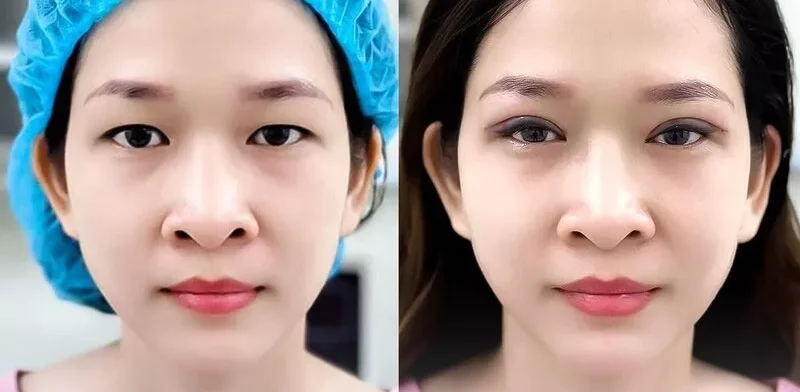 nhung hinh anh cat mi mat 2 e1758694536460