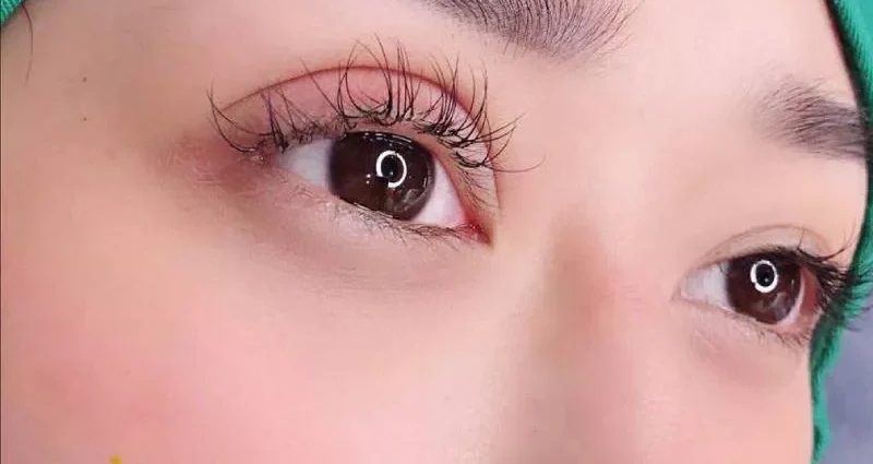 Cắt mí size 5, 6, 7, 8, 9 to hay nhỏ? 2 nhung hinh anh cat mi mat 6 e1758694894998