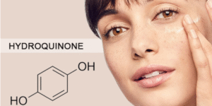 hydroquinone trị nám