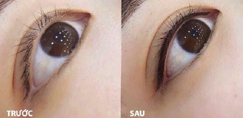 Xăm mí mắt dưới là gì? 8 phun mi mat duoi 11 e1757833462457
