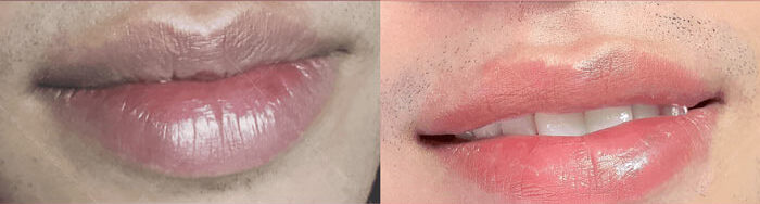 Phun Môi Bao Lâu Thì Lên Màu Và 6 Giai Đoạn Lên Màu Môi Đẹp Chuẩn 3 phun moi 10 e1757560006225