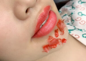 phun moi 2 ngay da bong 12 e1757917524813