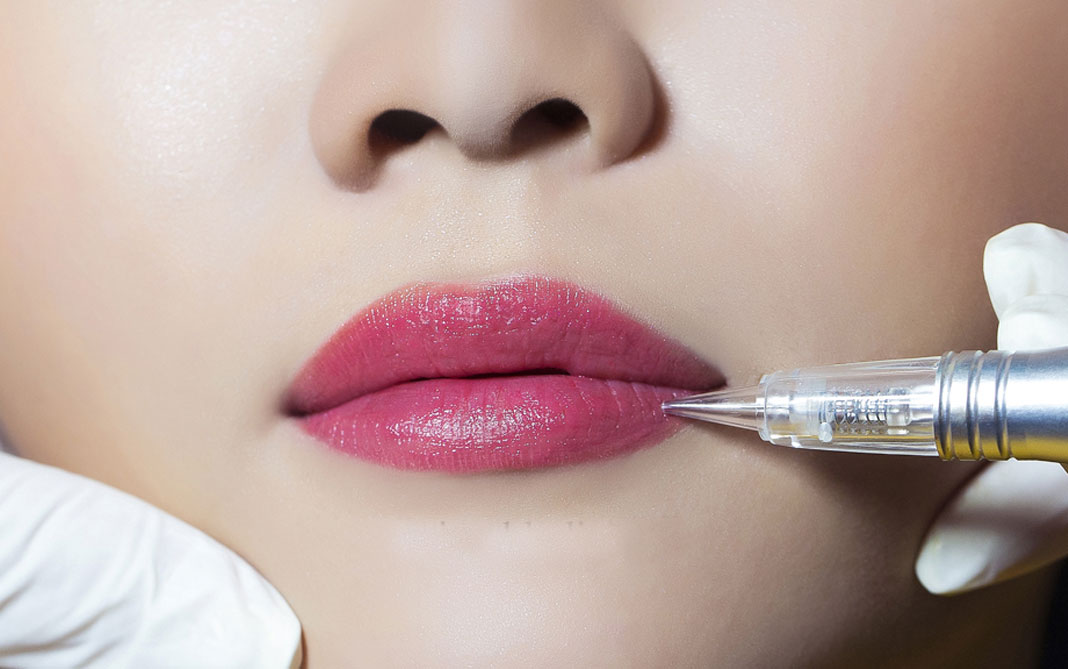 Nguyên nhân bị ngứa viền môi sau khi xăm và cách khắc phục 2 Bị tiểu đường xăm môi