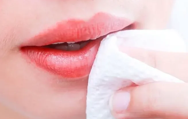 Phun môi bị bầm tím có nguy hiểm? Cách khắc phục hiệu quả nhất 3 phun moi bi bam tim 3 67be89d5b9361 e1757648730383