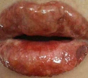 phun moi bi chay nuoc mo 1 1 e1757652086878