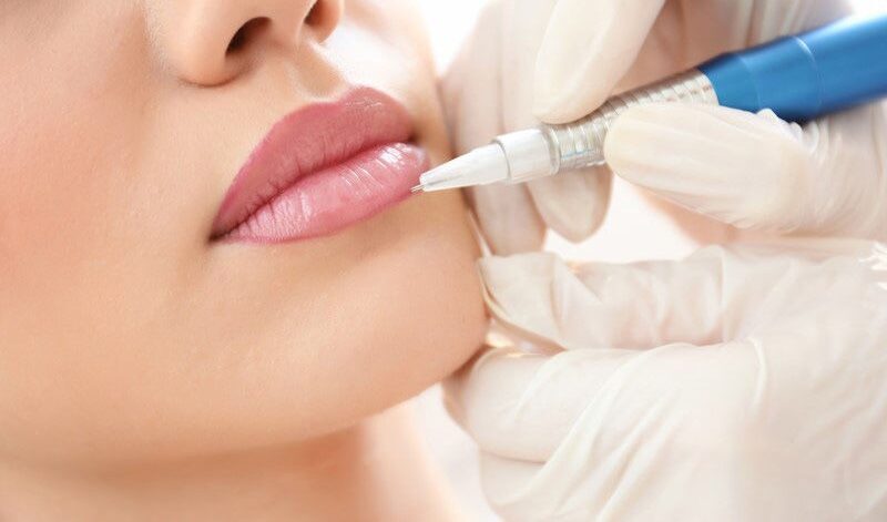 Phun môi bị lem viền: Nguyên nhân và cách khắc phục triệt để 1 phun moi bi lem vien 1 e1757650080474