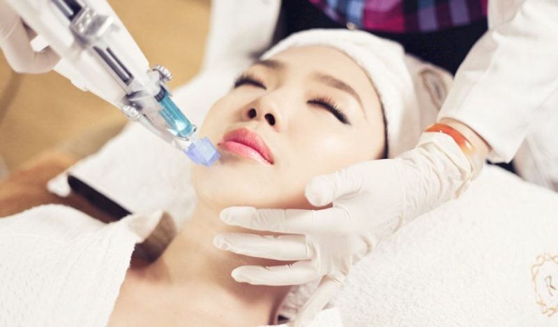 Phun môi bị lem viền: Nguyên nhân và cách khắc phục triệt để 4 phun moi bi lem vien 4 e1757650383125