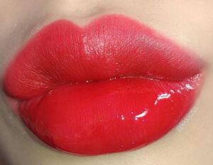 Môi sưng sau phun xăm