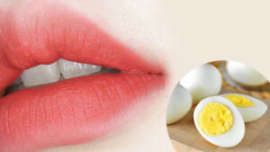 Phun môi ăn trứng vịt có được không?