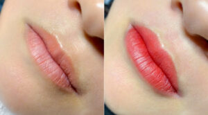 phun moi collagen mau do cam 11 768x768 1 e1757921187577