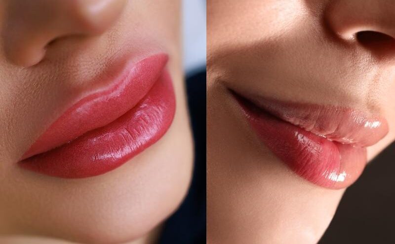 phun moi len mau dam qua 6 e1758359701880