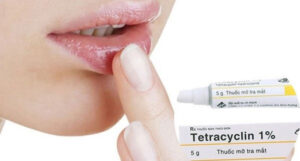 phun moi mau cam ca rot 5 e1757837025629