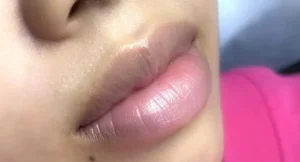 7 thói quen khiến môi thâm trở lại dù đã khử đẹp