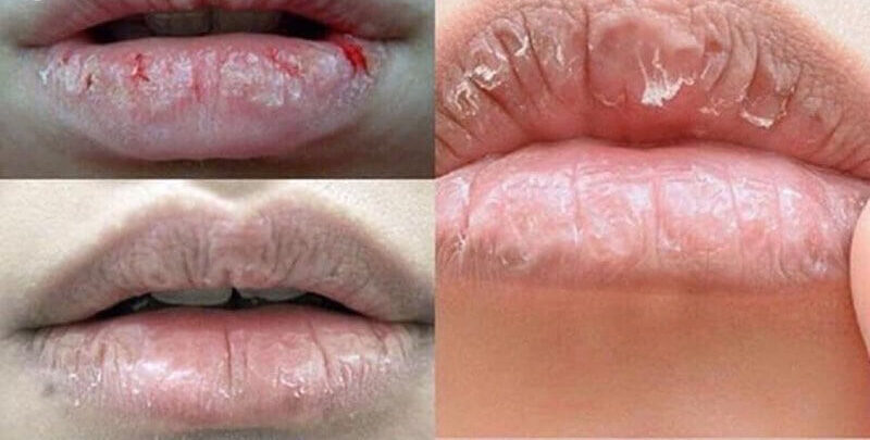 Phun môi tan viền là gì? Mức giá xăm môi tan viền bao nhiêu? 2 phun moi tan vien 7 661794d11c437 e1757575495753