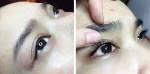 phun mi mat bi sung phai lam sao va nhung thac mac lien quan 2 5677e74058