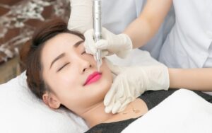 Cấy môi sinh học