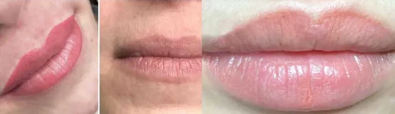 Tiết lộ quy trình phục hồi môi sau dặm môi lần 2 từ A-Z 2 quy trinh phuc hoi moi sau dam moi lan 2 2 67e267d3b3ed5 e1757579441695