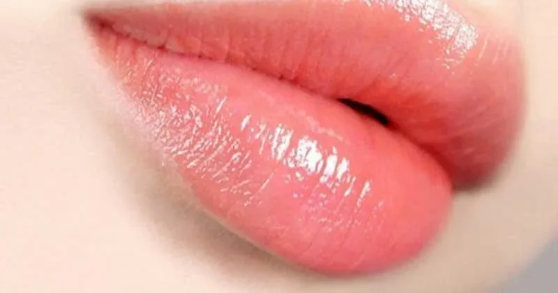 Tiết lộ quy trình phục hồi môi sau dặm môi lần 2 từ A-Z 5 quy trinh phuc hoi moi sau dam moi lan 2 5 67e267cf9f574 e1757579583324