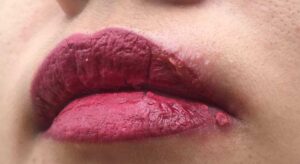 Xăm môi bị nổi mụn nước