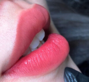 sau phun moi bi nhan 10 661dda3b68111 e1757748244503