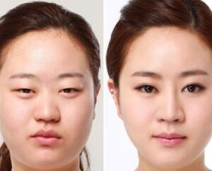 small 20230718 032450 656179 Cat mi mat giup cho max 1800x1800 jpg d1af450895