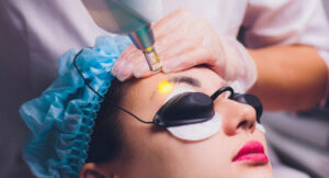 Sửa dáng lông mày đã phun: Khi nào nên sửa, khi nào cần xóa? 2 sua dang long may da phun 2 e1764056122637