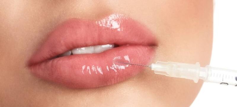 Tiêm filler bao lâu thì phun môi được? Có ảnh hưởng gì không? 1 tiem filler bao lau thi phun moi duoc 1 67491c8161f87 e1757659666602
