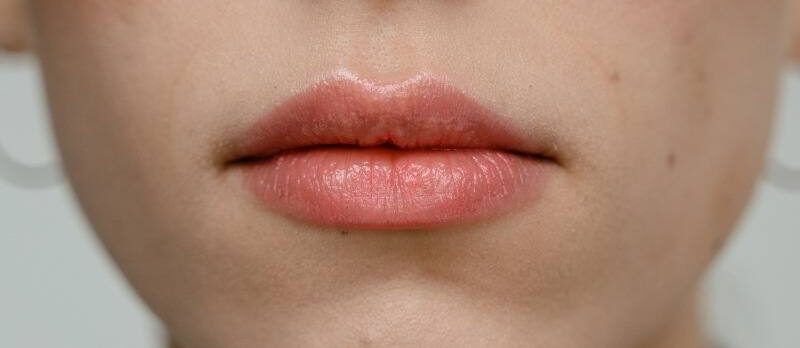 Tiêm filler bao lâu thì phun môi được? Có ảnh hưởng gì không? 4 tiem filler bao lau thi phun moi duoc 6 67491c8533207 e1757659941498