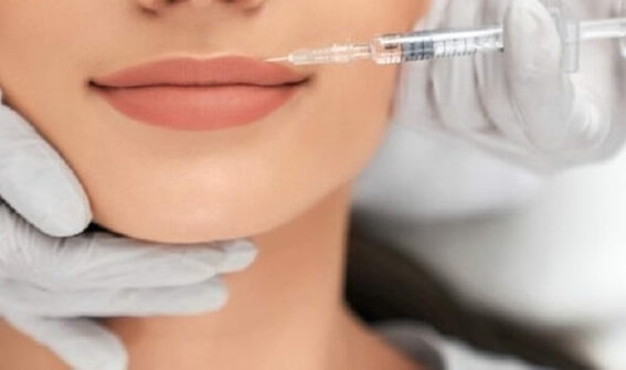 Tiêm Filler Môi 1 tiem filler moi 1 768x403 1 e1757952151591