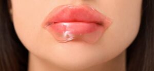 tri tham moi bang chanh 9 6736a6459ebe4 e1757666643516