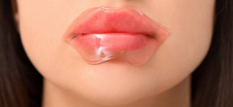 Trị thâm môi bằng chanh có hiệu quả không? 6 cách làm tại nhà 9 tri tham moi bang chanh 9 6736a6459ebe4 e1757666643516