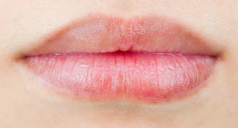 5 cách trị thâm môi với dầu dừa 2 tri tham moi bang dau dua 8 6735797873538 e1757667709387