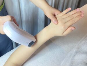 Triệt lông tay vĩnh viễn