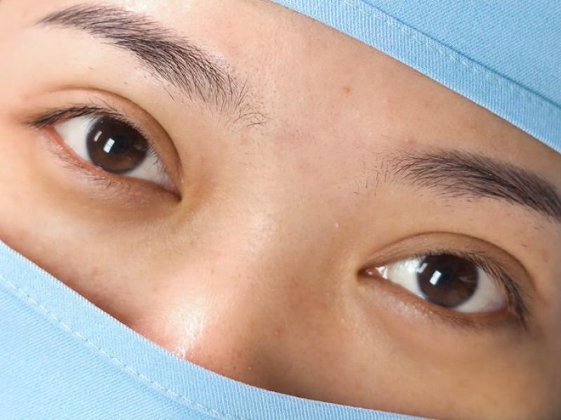 Phương pháp cắt mí Hàn Quốc 1 uu diem cua cat mi han quoc