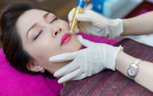 bị ngứa viền môi sau khi xăm