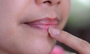 viền môi bị thâm sau khi xăm