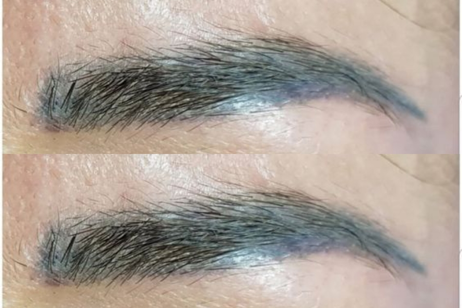 Chân Mày Trổ Xanh Là Gì? Nguyên Nhân, Cách Xử Lý 1 Chân Mày Trổ Xanh