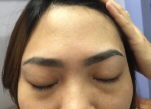 xam chan may loi 1 1