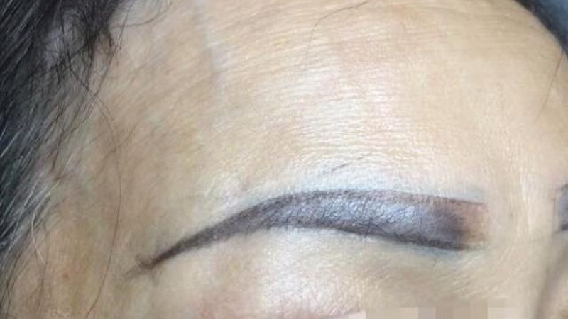 Phun xăm chân mày dáng xấu Phun xăm chân mày dáng xấu