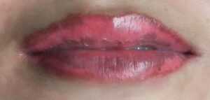 xam moi bi nhiem trung.1 66cfcd33bb357 768x512 1 e1758008833237