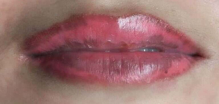 Phun môi màu hồng đào: Bí quyết để makeup tự nhiên, trong trẻo như sương mai 8 xam moi bi nhiem trung.1 66cfcd33bb357 768x512 1 e1758008833237